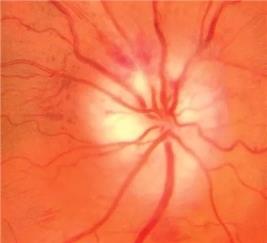 b5918f663dea41b1aecf062228c3586c