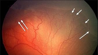 d9290e49gy1g1djsghnwcj20ku0bp14m